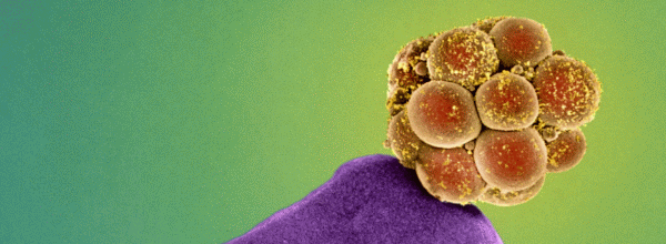 Human embryo at the 16 cell stage - Dr Yorgos Nikas, Science Photo Library